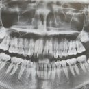 부마치과 이미지