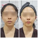 루시아의원 | 루시아 에스테틱 | 김포 장기동 웨딩관리로 유명한 에스테틱 작은얼굴 피부관리 받으러 다녀왔어요 :)