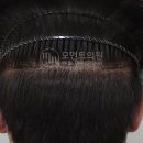 모먼트의원 이미지