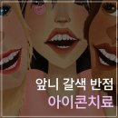 단계반점 이미지