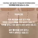 심한 비탈길 이미지