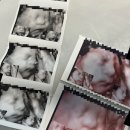 11545-11-31-28 | 임신 기록 #11 :: 28주 임신 기록 일상 (정밀초음파)ㅣ임당 식단ㅣ리브레 연속혈당측정기 내돈내산...