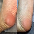 압구정평생학습관 | 압구정 패디플래닝 발각질제거 압구정VIP슈가링왁싱테라피에서 아기발되기