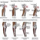 Lumbar Spine) 움직임 교정을 통한 기능의 회복 / 허리의 운동손상과 치료 방법 세미나 이미지