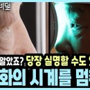20대 안구건조증이 60대 망막 상태가 된 충격적 이유 당신의 눈 노화, 이미 시작됐습니다 이미지