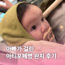 수리폼세탁 | [아기띠] 아빠가 걸린 아티포페병 완치 후기 | 자이가이스트 아거스 오트 5개월 실 사용기 (세척법...