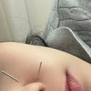 도선한의원 | 춘천 한의원 추천, 임산부 환도선다 치료 후기(+임산부 진료비 할인)