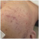 아이스킨 이미지