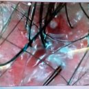 바른인한의원 이미지