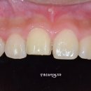 오케이치과기공소 이미지