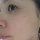 기미 잡티 제거 크림, 정말 가능할까? 제대로 알고 고르는 법 이미지