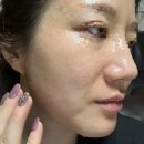 엘바피부샵 이미지