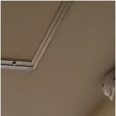 청산의동보건진료소 | 강남역임플란트치과 참고할 주의사항