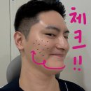 닥터윤뷰티플의원 | 불당동피부과 진료 기미 고민이라면 3가지만 체크