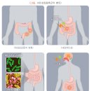 한사랑내과 네이버블로그