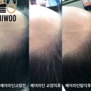 미우아카데미 라인