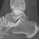 서울척척정형외과의원 이미지