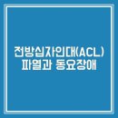 전방십자인대 파열과 후유장해(동요장해) 이미지