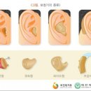 손권희난청지원센터