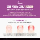 레푸스n바바 이미지