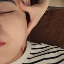 컴포즈커피부평역이편한시티점 | 신부관리로 좋은 레이저 후 색소침착관리 밀크필,부평피부관리 후기