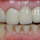 에나멜 치과기공소 이미지