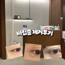 성남 산성역 포레스티아 피부과 비립종 제거 후기