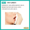 방귀를 참으면 안되는이유4가지.. 이미지