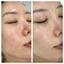 아티스트 인 대구 <김은형> | [대구/달서구] 감삼동 피부관리실 붉음증 완화 셀리아