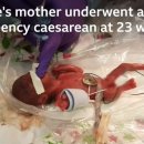 엄지공주 이미지