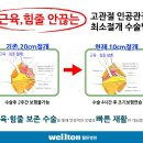 고관절통증 원인과 치료방법, 대퇴골두무혈성괴사란? 고관절인공관절수술은 무엇일까? 이미지