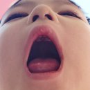 소아과잉치 어린이치과 수술 후기