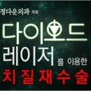 신레이저 | [동작구 치질 대장항문외과] 정다운외과 - 치핵수술 진솔리얼후기