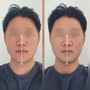 위너메디칼 | 피부과 리프팅 프로그램에 위너지로 한 단계 높은 리프팅 관리를 완성하세요.