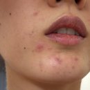 연세화온의원 이미지