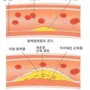 고지혈증에 좋은 음식 이미지