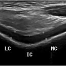 본큐어한의원 이미지