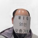 대성우체국 앞 | 대구 맞춤가발 후기 ㅣ 30년 가발 착용 고객님이 선택한 진짜 자연스러운 남자 맞춤가발