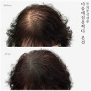 마음에점을찍다제주점 | 광주두피문신 고민이라면? SMP두피문신 상담부터 꼼꼼했던 마음에 점을 찍다 광주본점 후기👨‍🦰