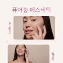 퓨어에스테틱 이미지