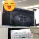 순천향구강악안면외과치과의원 | 사랑니 발치. 잠실숲사랑니구강악안면외과치과의원치과