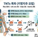 TNTs 폭파 (키명지추 요법) 이미지