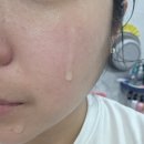 5430 | 메디페어 플라즈마 세럼 크림 붉은기 진정 각질 케어 후기