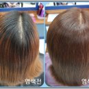 케어큐 이미지
