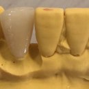 수치과기공소 이미지