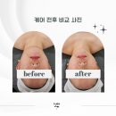 사과같은내얼굴 티스토리