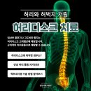 21세기신경외과병원 | 광명신경외과 앉을 때 발생하는 허리와 허벅지 저림 원인