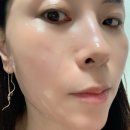 탄력모공리프팅 뷰티디바이스 홈쎄라 한달애 30일 구독 서비스 후기