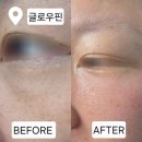 봉곡로23길-5 | 구미피부관리 잘하는곳 추천 💆🏻‍♀️ 글로우핀에서 눈밑 리프팅 관리 후기!