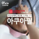 오라클 피부관리 이미지